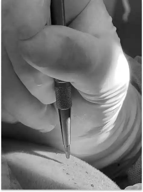 Instrumental FUE Zafiro en contexto clínico