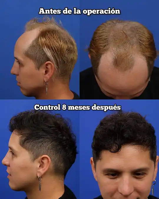 Resultado de Yohans Ogaz